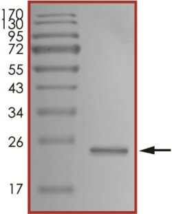 Sino Biological&nbsp;Recombinant Human Tau Protein (Tau-441, AVI Tag), Biotinylated